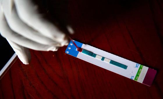 На фото: тест на выявление вируса иммунодефицита человека (ВИЧ). 